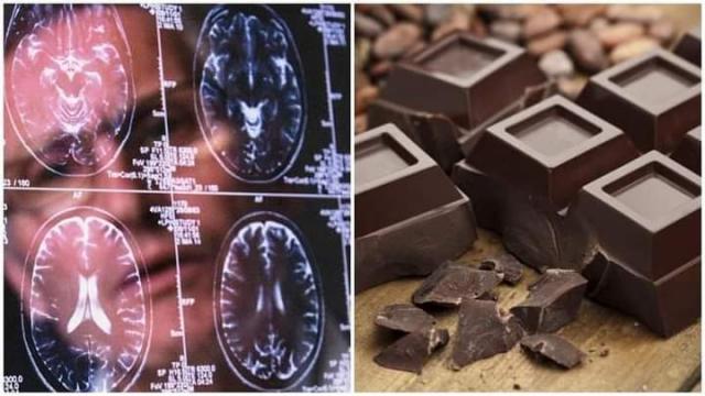 نيزرلاندس ميديكال : تناول الشوكولاتة الداكنة يعزز عمل النظام المناعي ووظائف المخ