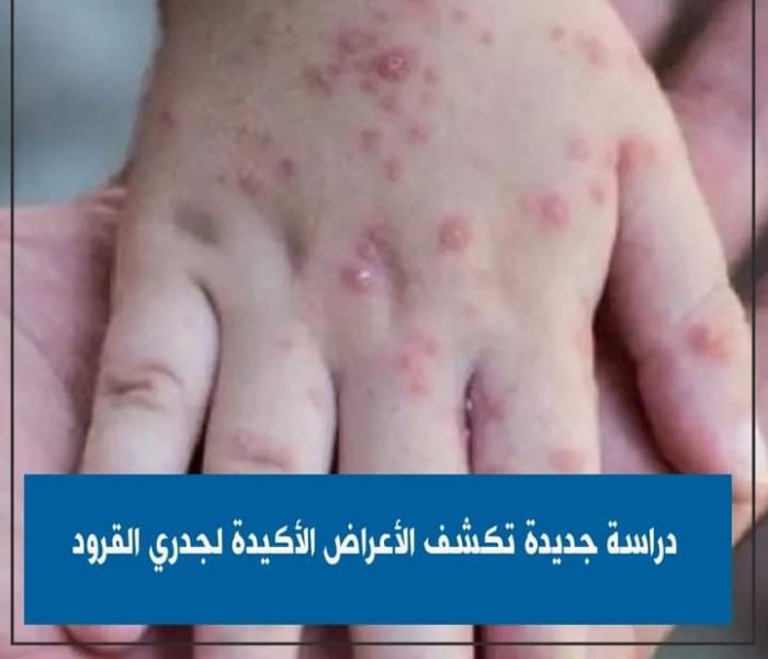 صورة تعبيرية