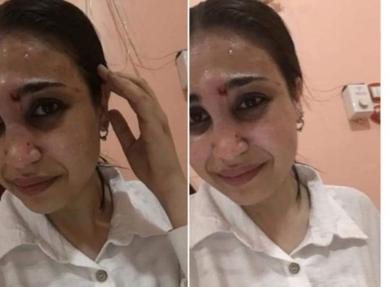 الداخلية : كشف ملابسات واقعة نشر صورة فتاة محبوسة وتتعرض للضرب من والدها