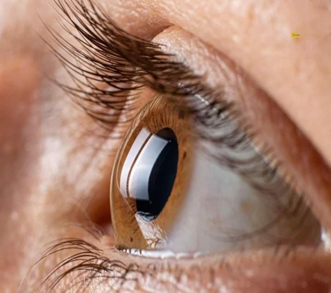 هاني حمزه : علاج جديد لاعتلال شبكية العين السكري