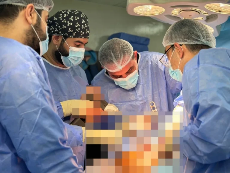 تدريسي في كلية طب المستنصرية يقوم باجراء عملية رفع ورم عظمي من أسفل عظم القصبة لمريض في مستشفى اليرموك التعليمي