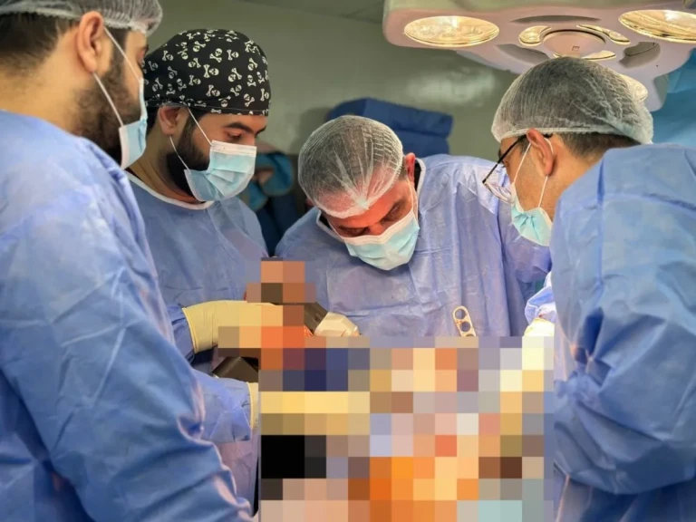 إجراء عملية ناجحة لتبديل مفصلي الركبتين لمريض في مستشفى اليرموك التعليمي في كلية طب المستنصرية ببغداد