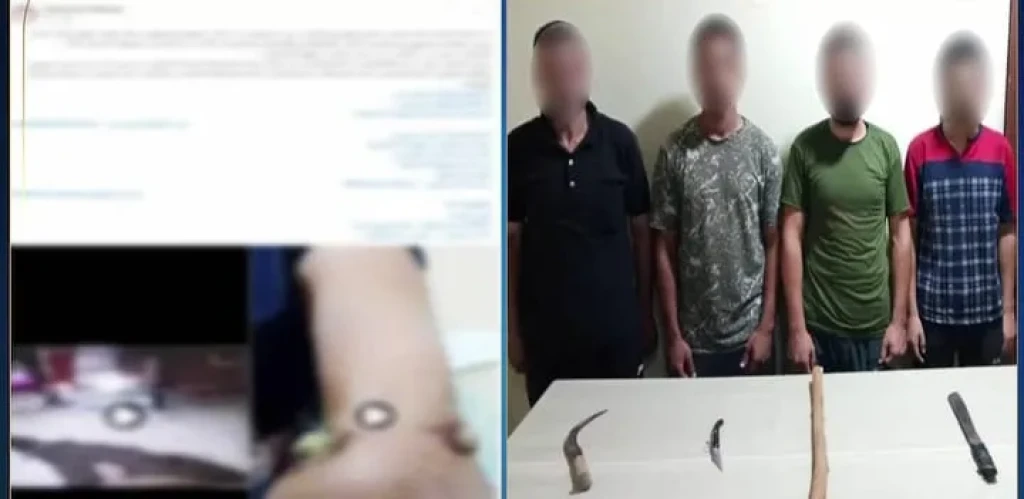 الداخلية: ضبط عدد من الأشخاص بالتعدى على آخر بإستخدام أسلحة بيضاء وعصى خشبية بالبحيرة
