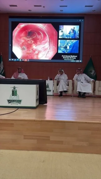 جامعة حلوان تشارك ببث حي لعملية مناظير دقيقة في المؤتمر الدولي الثاني بجدة