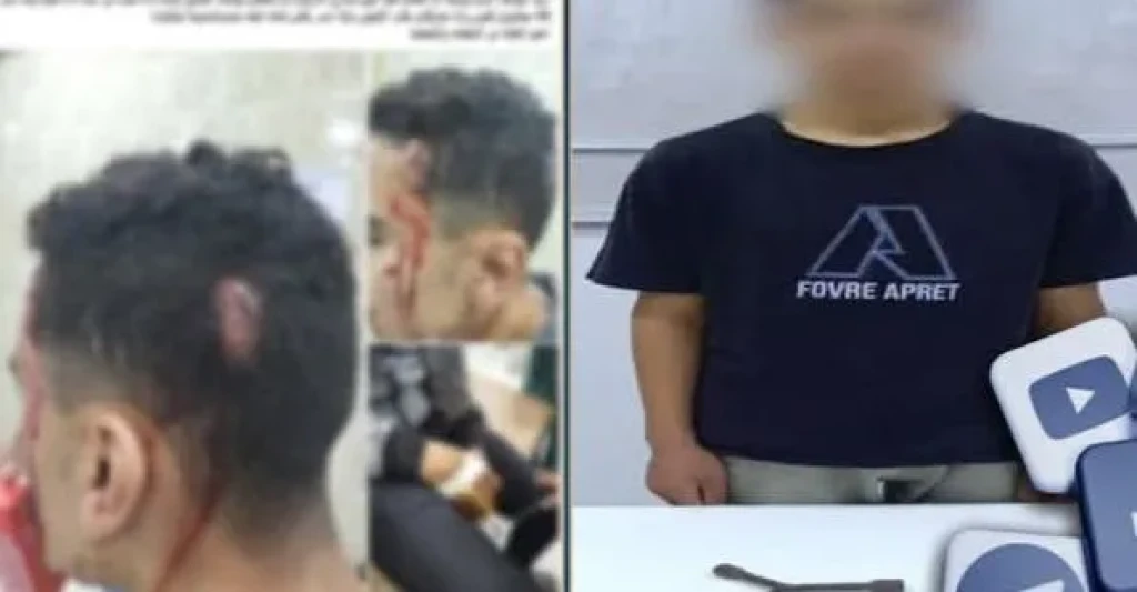 الداخلية: ضبط أحد الأشخاص بالتعدي على آخر بقطعة حديدية وإحداث إصابته بالشرقية