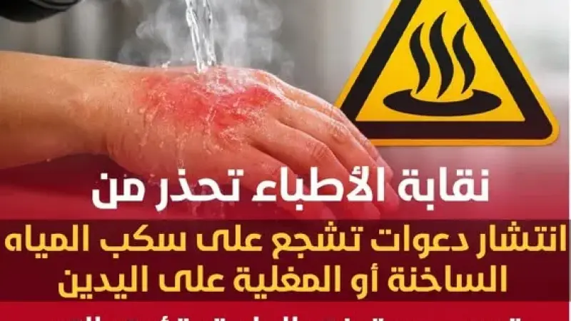 نقابة الأطباء تحذر من انتشار دعوات تشجع على سكب المياه الساخنة أو المغلية على اليدين