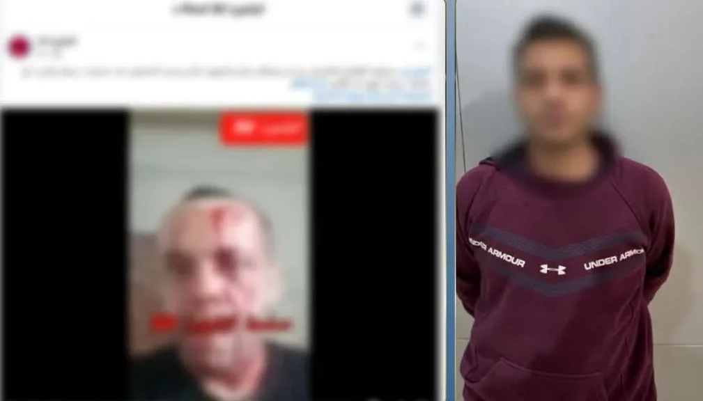 الداخلية: كشف ملابسات مقطع فيديو التعدي علي أحد الأشخاص وإصابته بالقاهرة