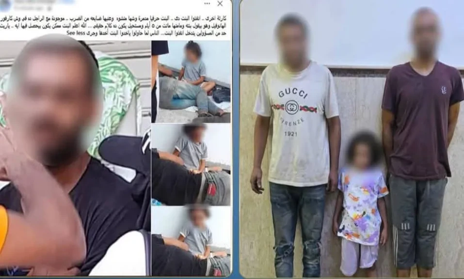 الداخلية: كشف ملابسات صور طفلة يظهر عليها آثار تورم بالعينين وإصابات بالوجه بالإسكندرية